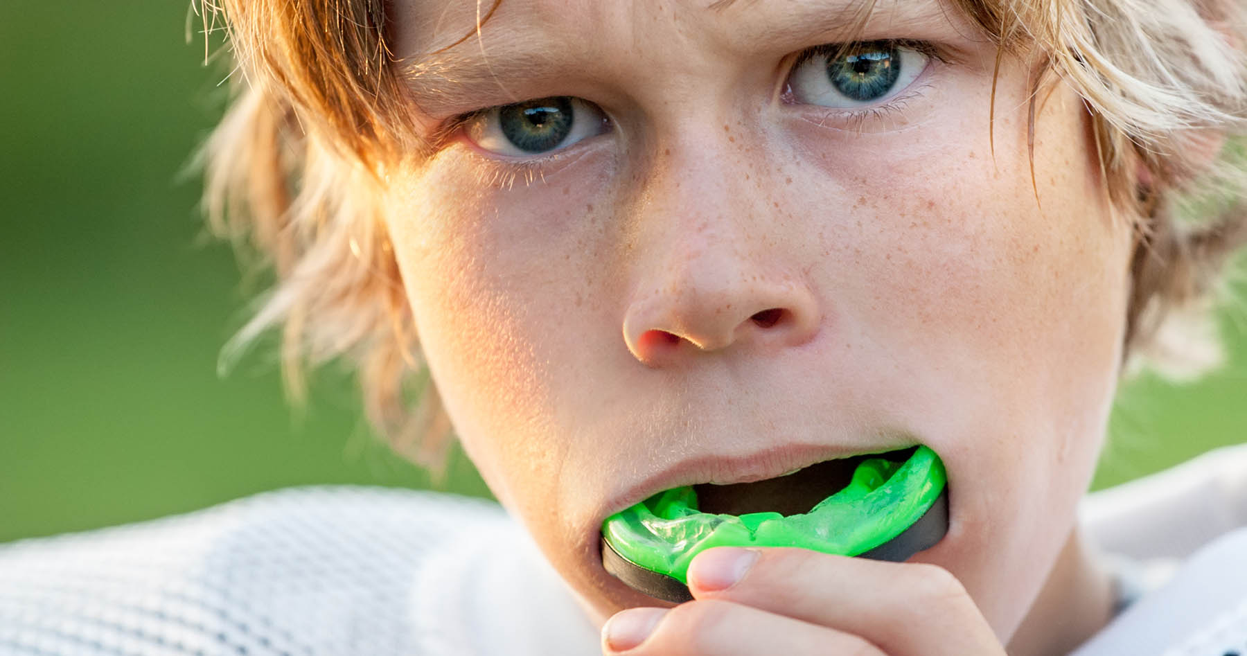 Mouthguard Mouthguard