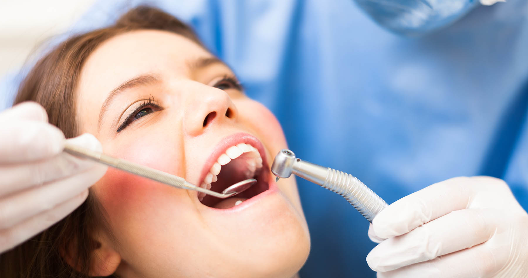 Dental Sealants