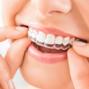 Invisalign
